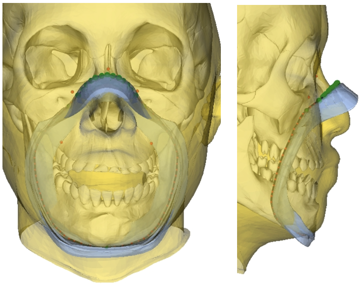 Oxygen mask contour over imputed skull geometry