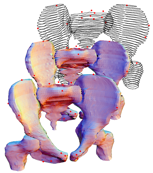 Child pelvis mesh model